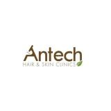 Antech Hair Clinic