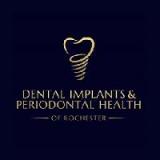 Dental Implants & Periodontal Health